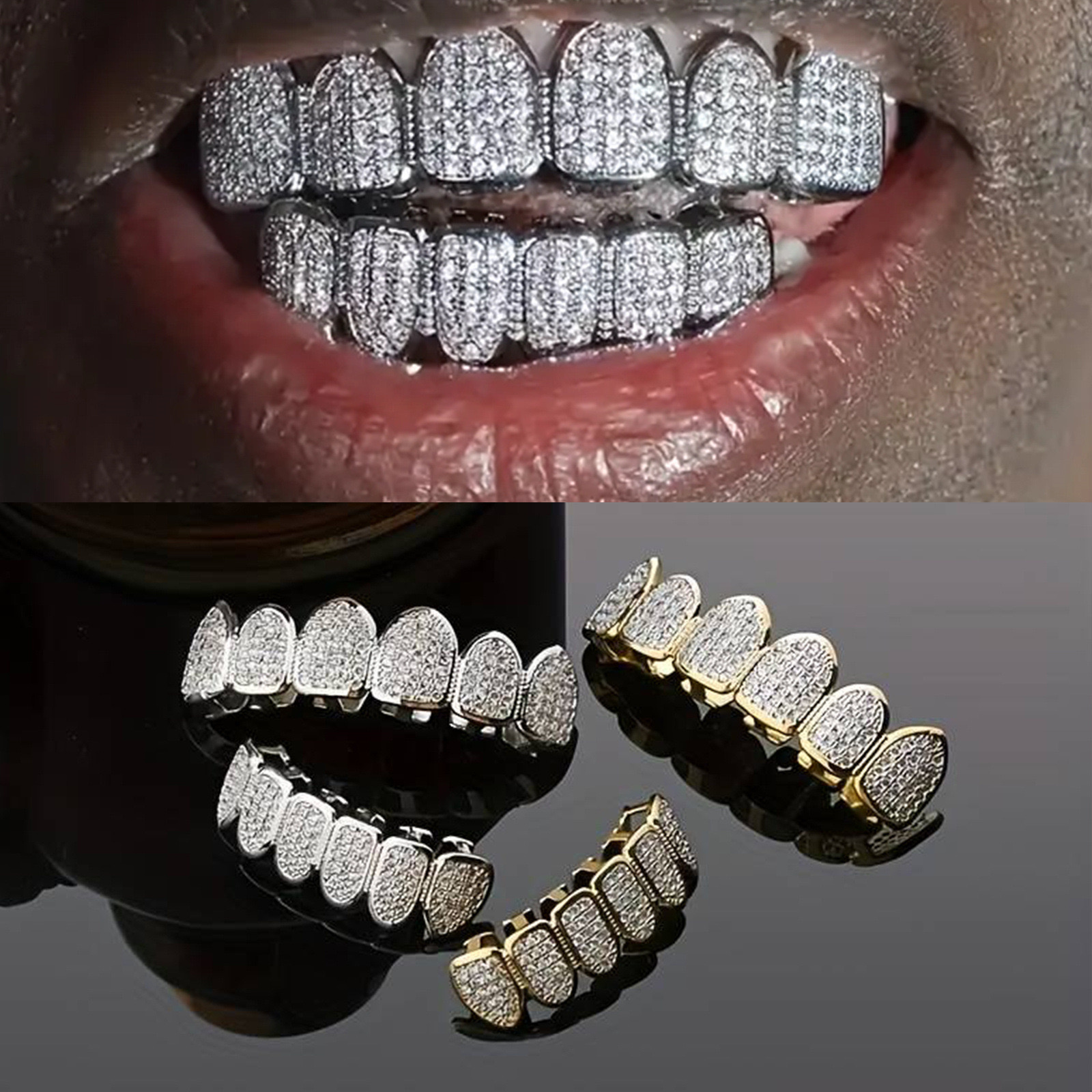 IMG_1365 Zircon Teeth Braces set - Image 1